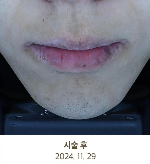 Before