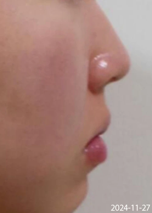Before