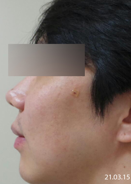 Before
