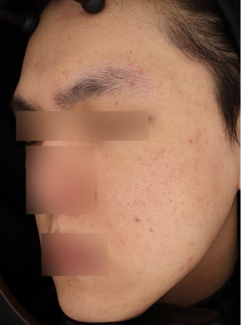 Before