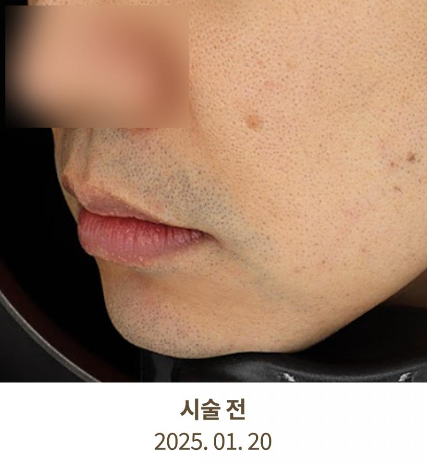 Before