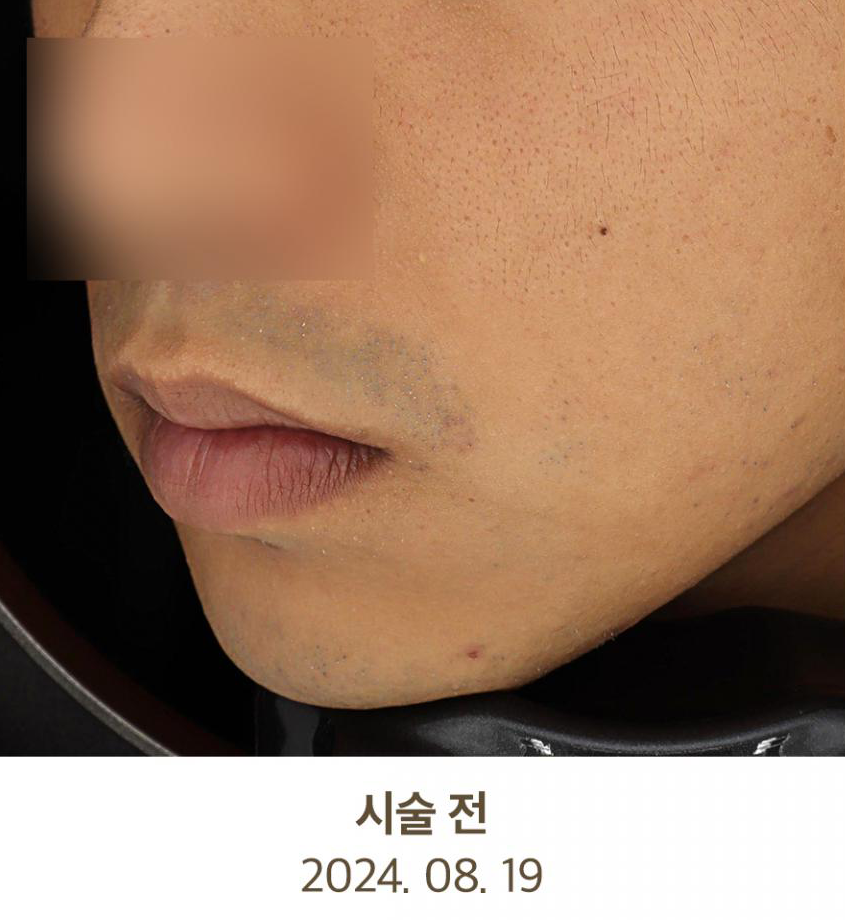 Before