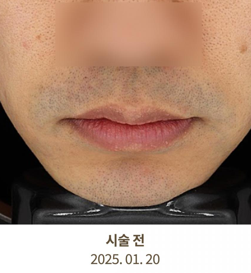 Before