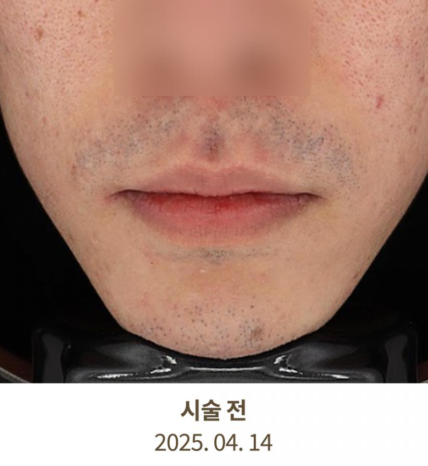 Before