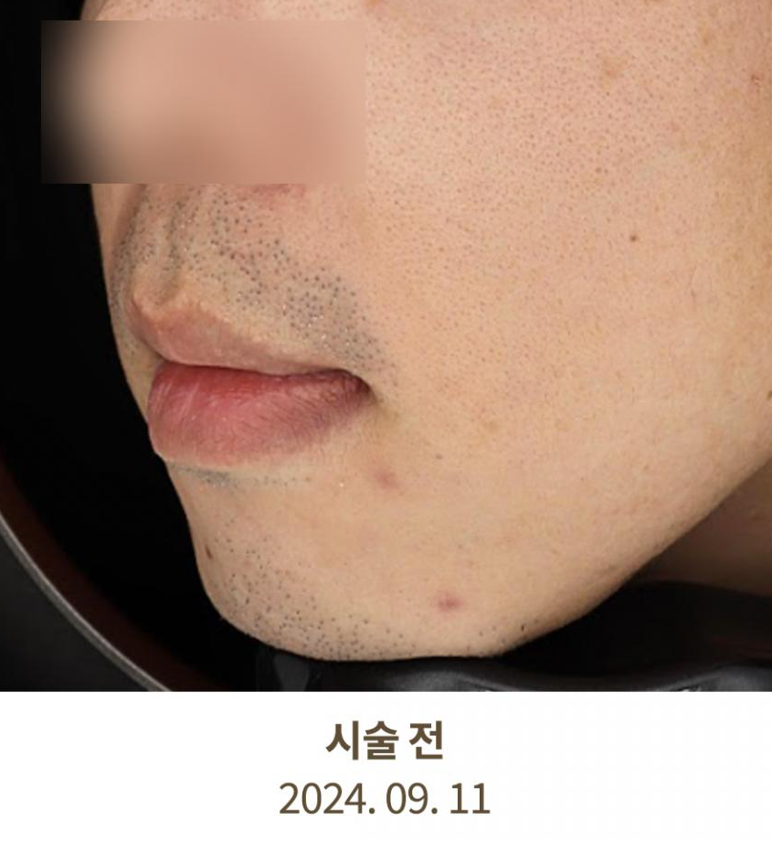 Before