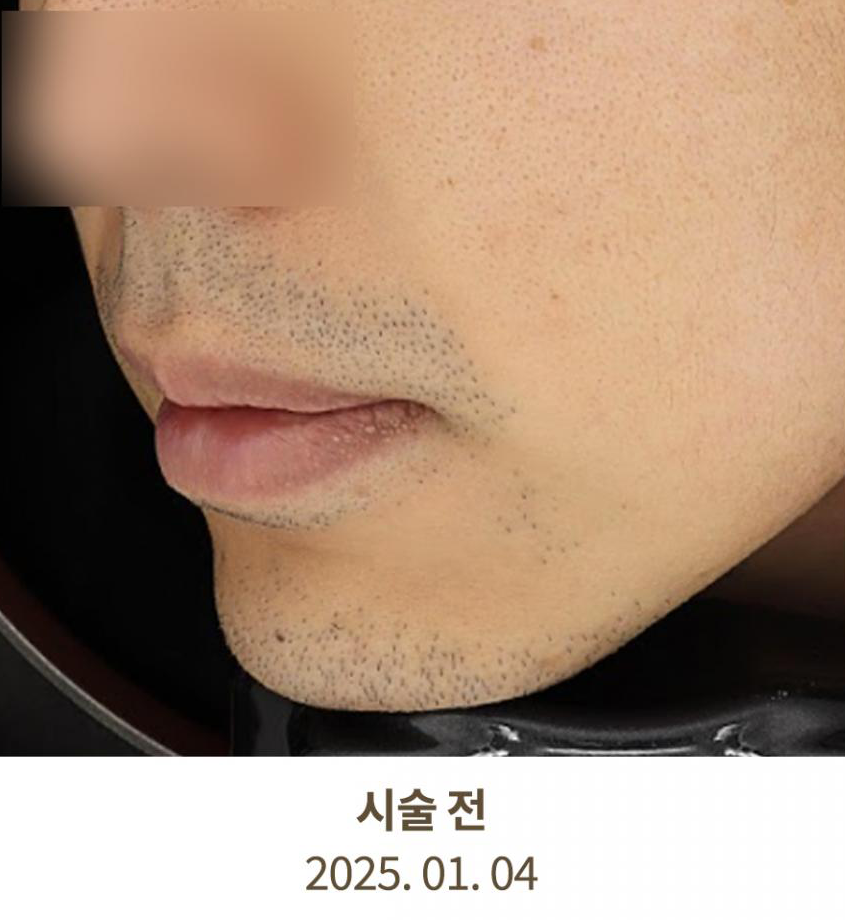 Before