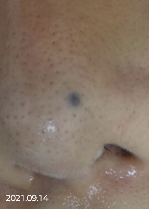 Before