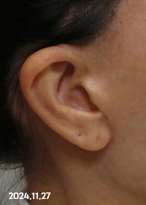 Before