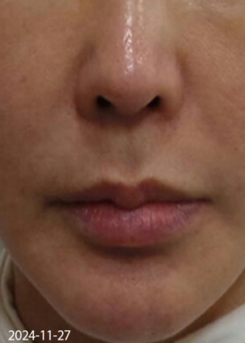 Before