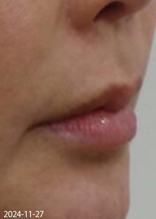 Before
