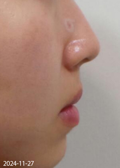 Before