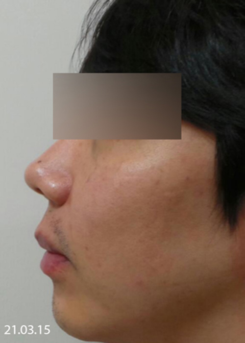 Before
