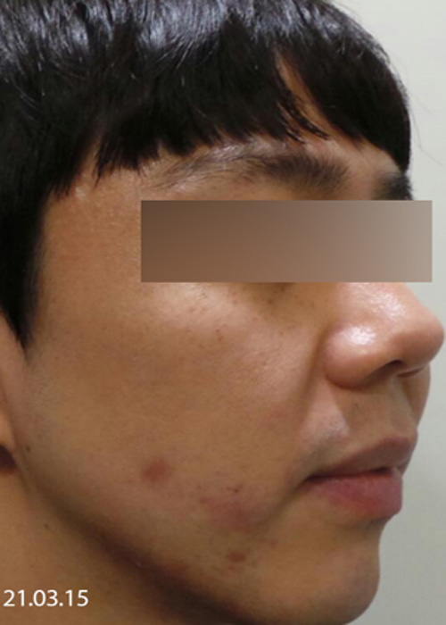 Before
